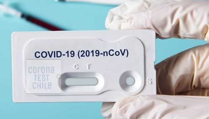 Noticias Chile | Sernac denuncia ante la justicia a Corona Test por publicidad engañosa y una posible estafa