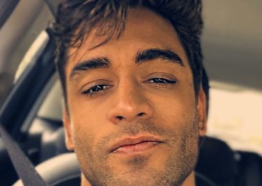 Noticias Chile | Ex bailarín Thiago Cunha lo está pasando mal, tiene parálisis en su rostro