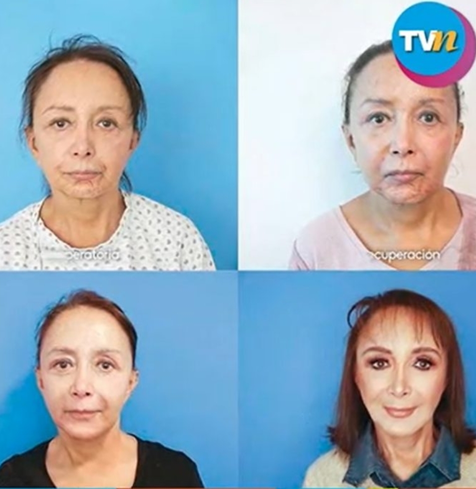 Noticias Chile | Informadorchile